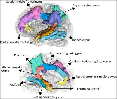 Impact of hs-CRP concentration on brain structure alterations and cognitive trajectory in Alzheimer’s disease